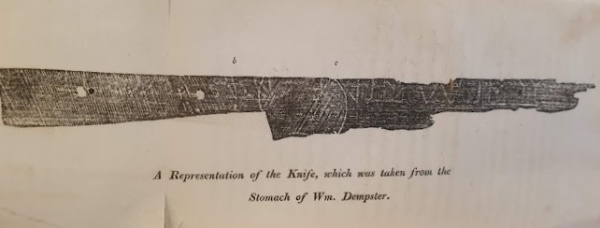 A statement of the case of Wm. Dempster, a juggler who died in consequence of having swallowed a table-knife, by Hadfield, G. J. (1824) (TRACTS A131(19))