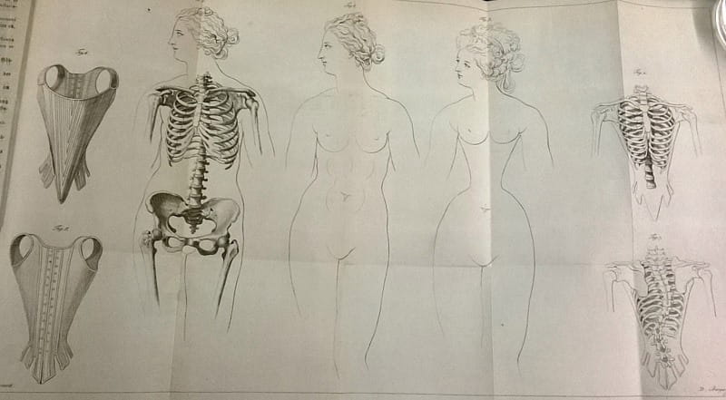 In 1908, a Doctor Used X-Rays to Highlight the Damaging Effects of Tight  Corsets on a Woman's Body ~ Vintage Everyday