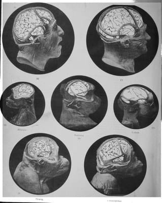 D.J. Cunningham, Contribution to the Surface Anatomy of the Cerebral Hemispheres (Dublin, Royal Irish Academy, 1892). Plate VIII.