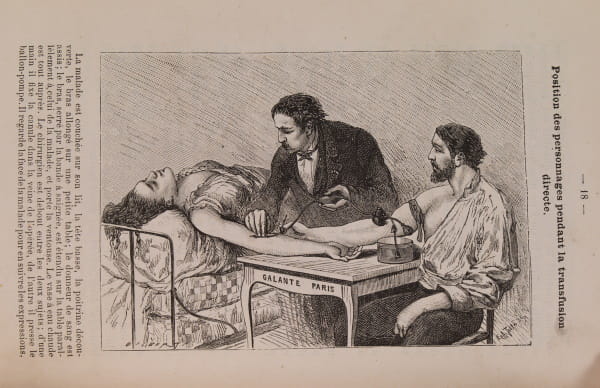 Transfusion directe du sang vivant, by Roussel, J. (1882) (TRACTS 228(3))