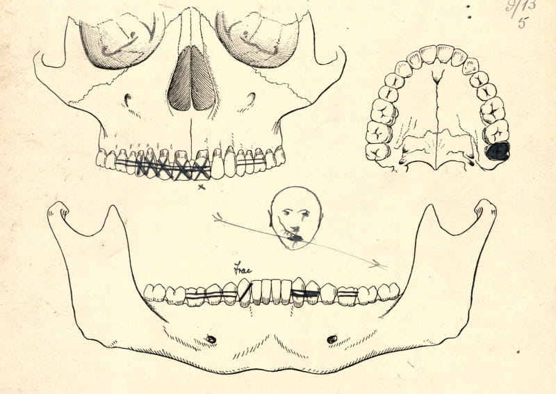 Diagram from MS0563/7