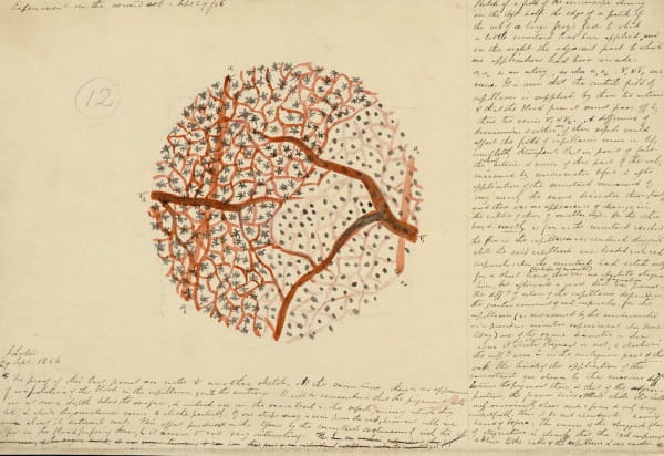 Handwritten notes and a close-up drawing of skin