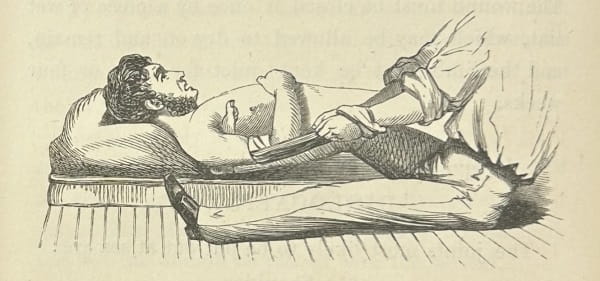 Drawing showing a man lying on his back on the floor, while a second man pulls on a cloth tied around the first's upper arm, and braces a foot against his shoulder.