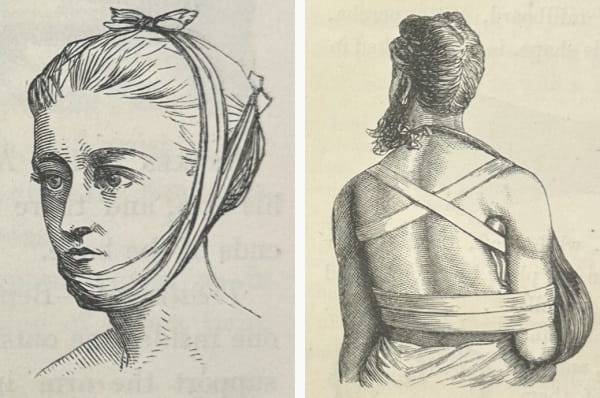 Drawings of a woman's head with bandages wrapped around her jaw, and of a man's back with a sling and additional bandages.