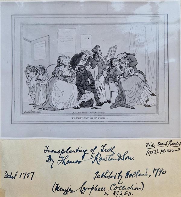 An album page containing a drawing, described in the main text of this post, entitled 'Transplanting of Teeth'. The page is captioned 'Transplanting of Teeth by Thomas RowlandsonSketched 1787. Published by Holland, 1790. (Menzies Campbell Collection in RCSEd.)'